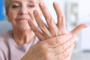 Arthritis Pain
