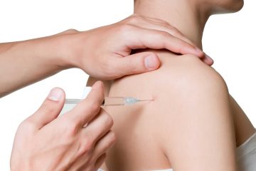 Trigger Point Injections