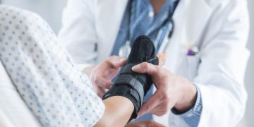 What to know about bone fracture repair